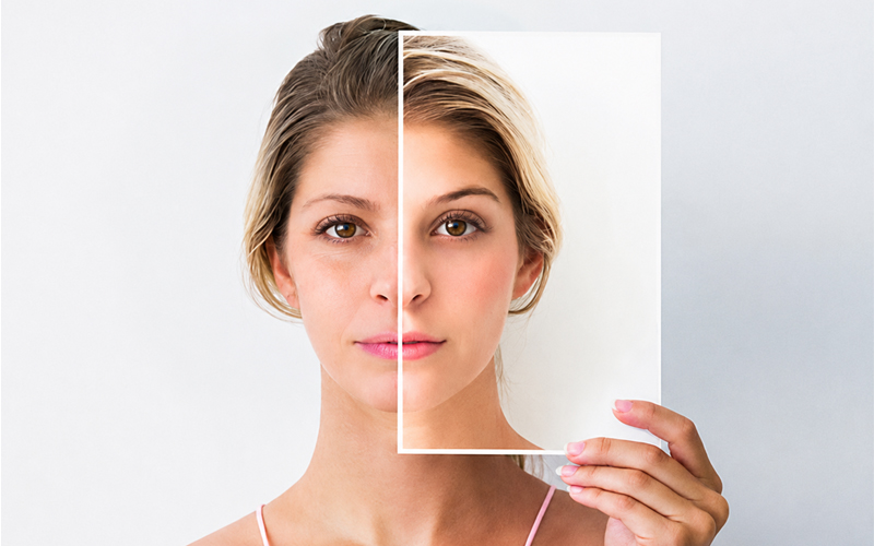 Anti-aging treatment in Nellore at Sri Skin and Hair Clinic